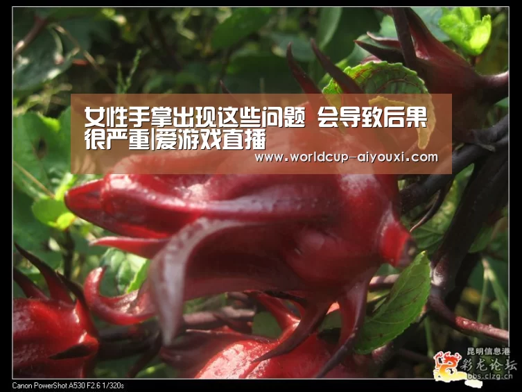 女性手掌出现这些问题 会导致后果很严重|爱游戏直播(图1) 爱游戏直播