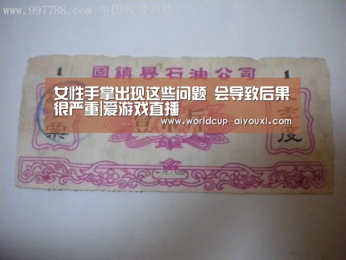 女性手掌出现这些问题 会导致后果很严重|爱游戏直播(图2) 体育直播
